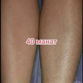Ada/депиляция