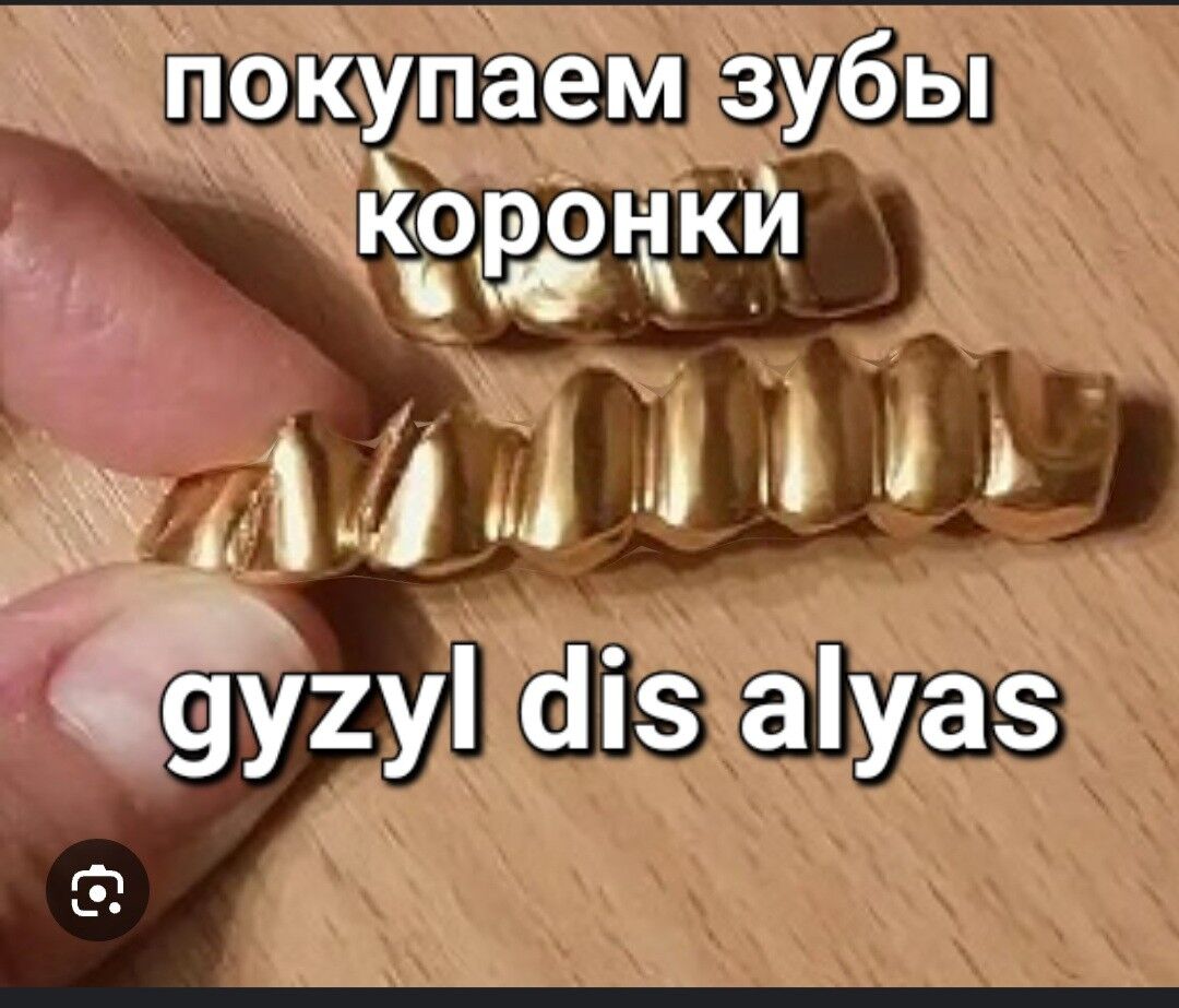 gyzyl diś alyas скупка золота - Aşgabat - img 5
