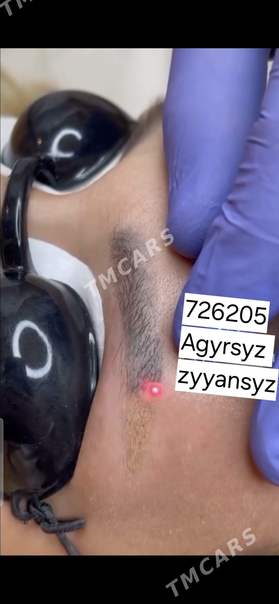 Permanent Tatu Ayyrmak Lazer - Ашхабад - img 2