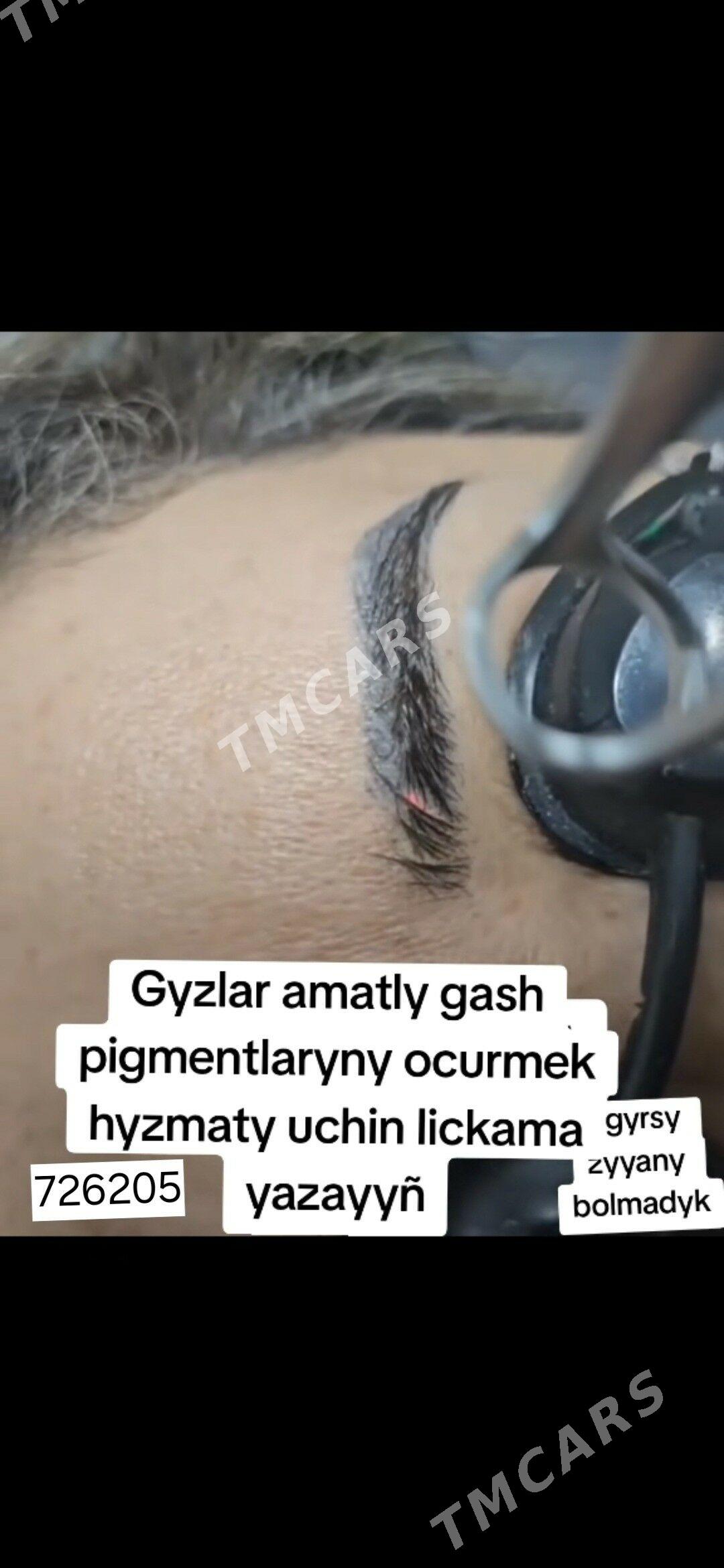 Permanent Tatu Ayyrmak Lazer - Ашхабад - img 3