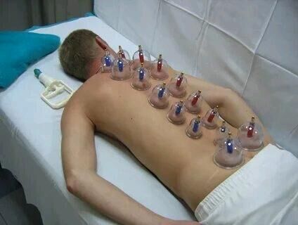 Hijama bankalar - Daşoguz - img 7