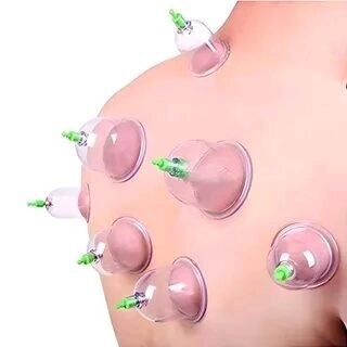 Hijama bankalar - Daşoguz - img 6