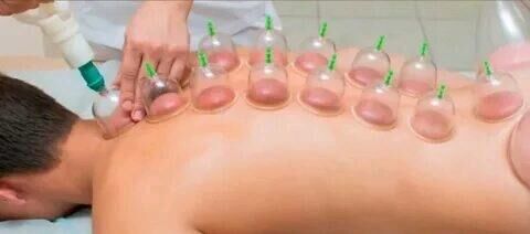 Hijama bankalar - Daşoguz - img 8