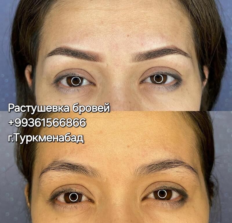 Скидки на Губы и Брови - Туркменабат - img 10
