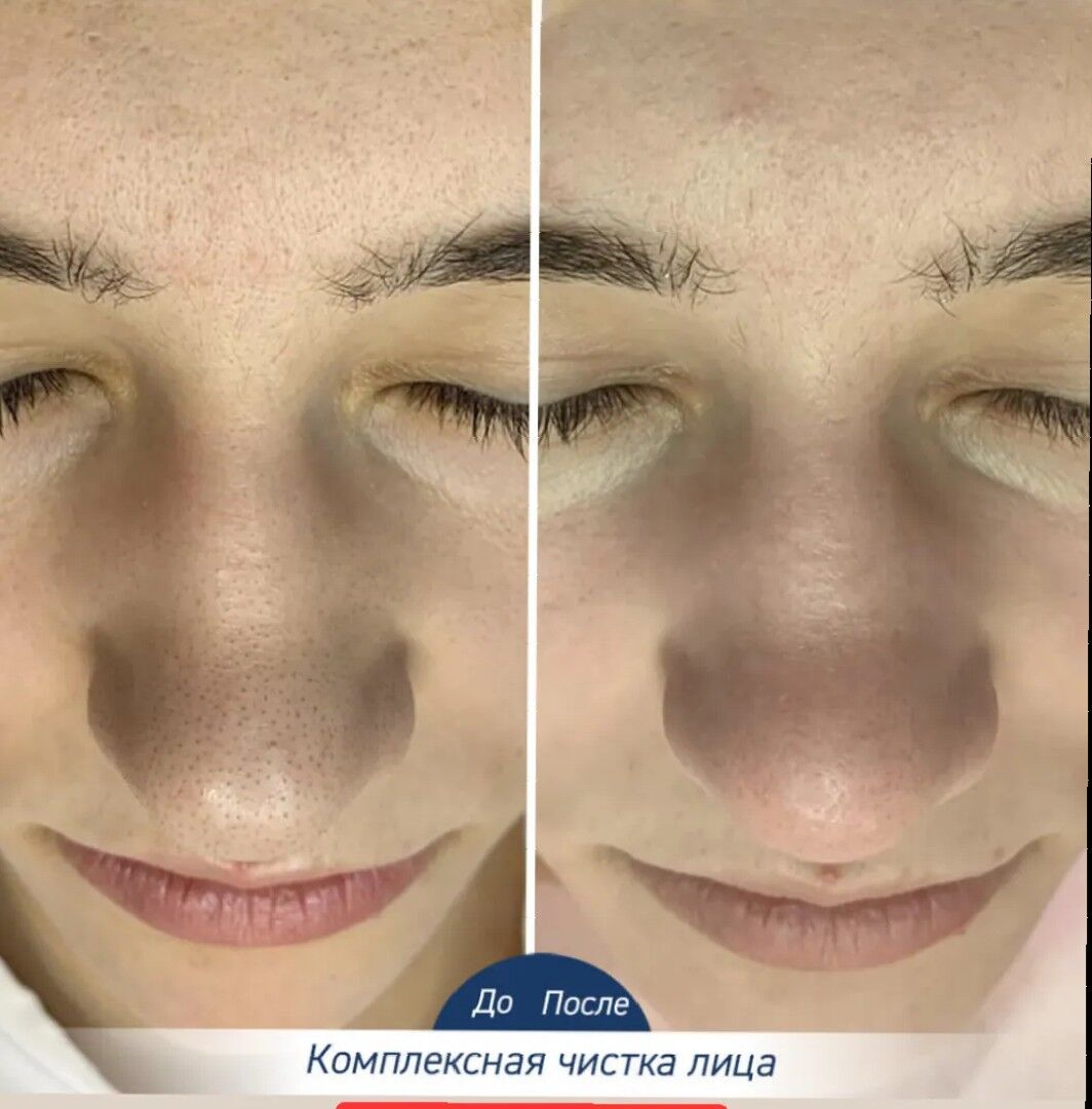 COSMETOLOGY ESTHETIC НА ВЫЕЗД - Туркменбаши - img 3