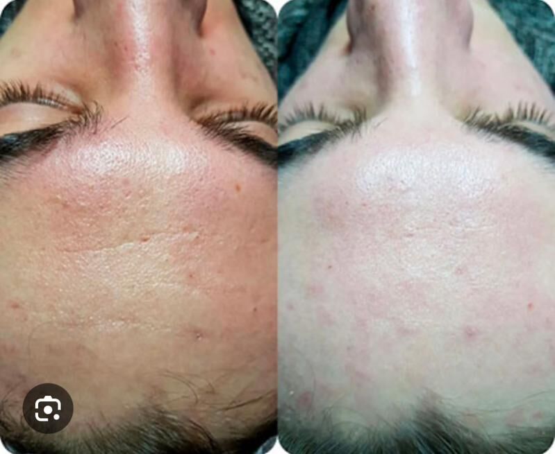 Farforywy kukla salon - Podwoýski köç. (Bitarap Türkmenistan şaýoly) - img 3