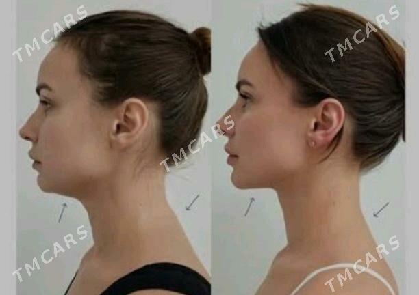 SALON İŞİ - Hitrowka - img 3