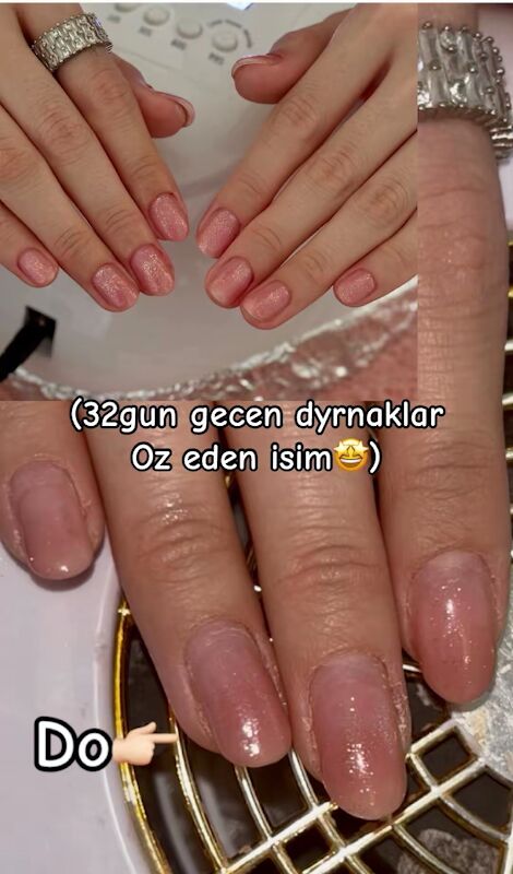 dyrnak narasewanya - Мир 2 - img 8