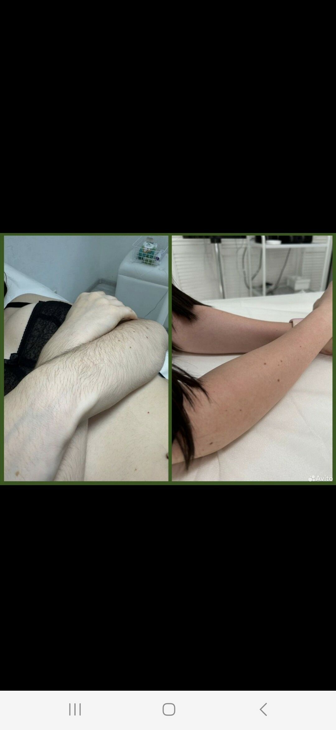 Narasiwaniye kirpik - Büzmeýin - img 2