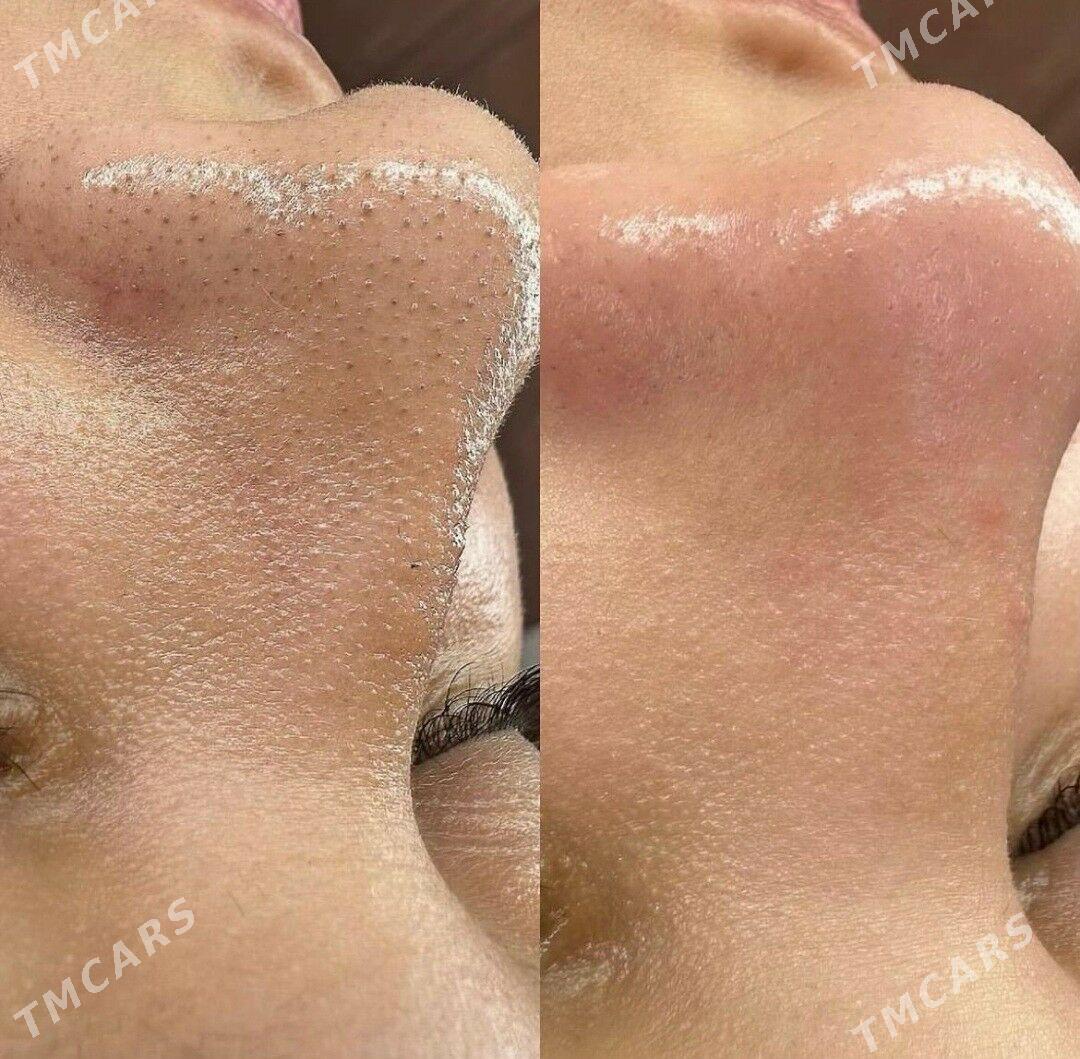 Kirpik dakmak, ýûze ideg emerg - Гуртли - img 6