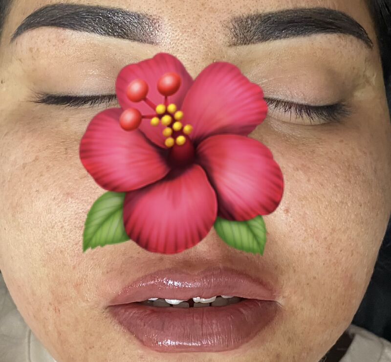 Permament, mikrobleyding - Türkmenabat - img 6