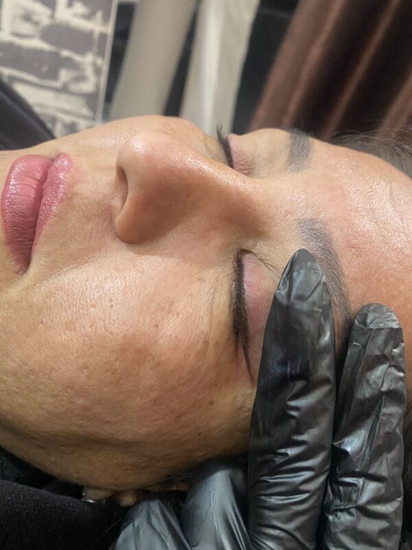 Permament, mikrobleyding - Türkmenabat - img 10