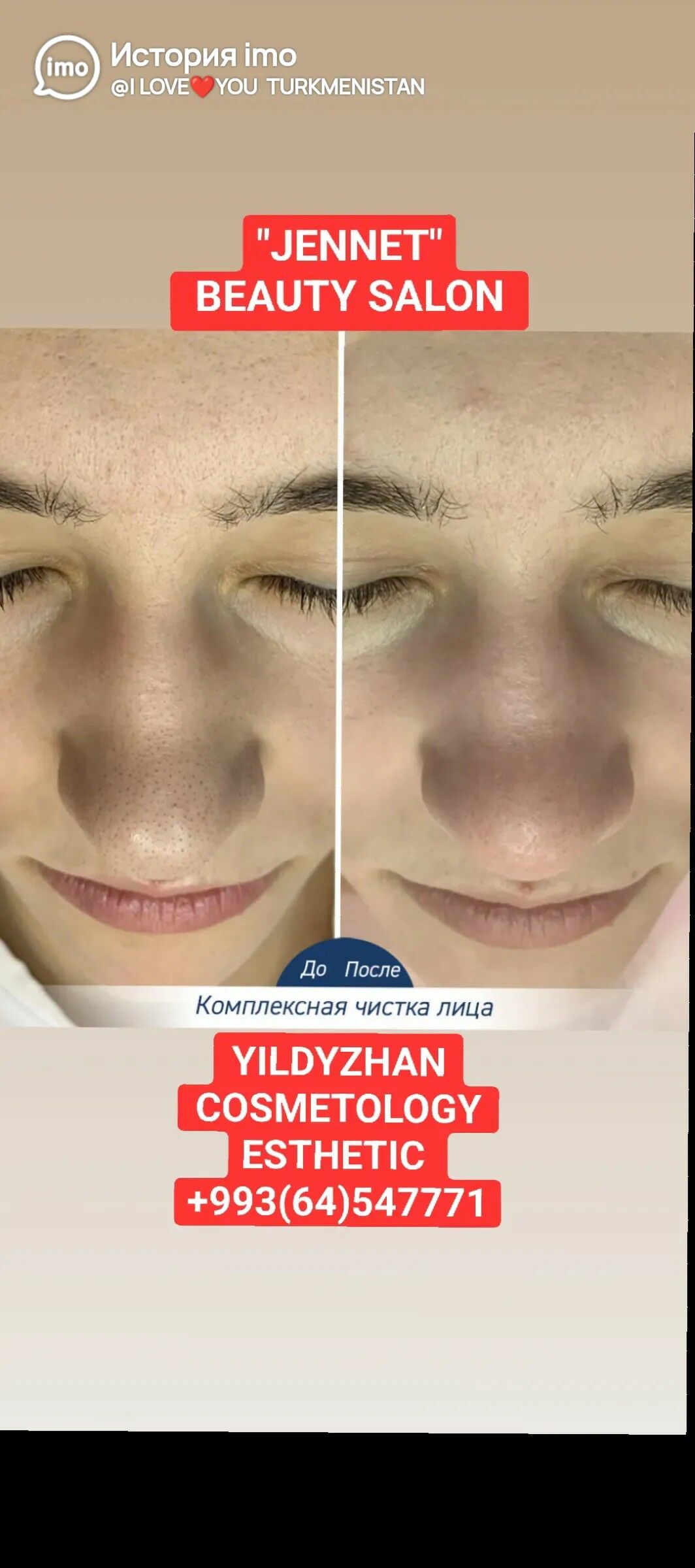 COSMETOLOG- ESTETIK🪞🧴BEAUTY - Ашхабад - img 6