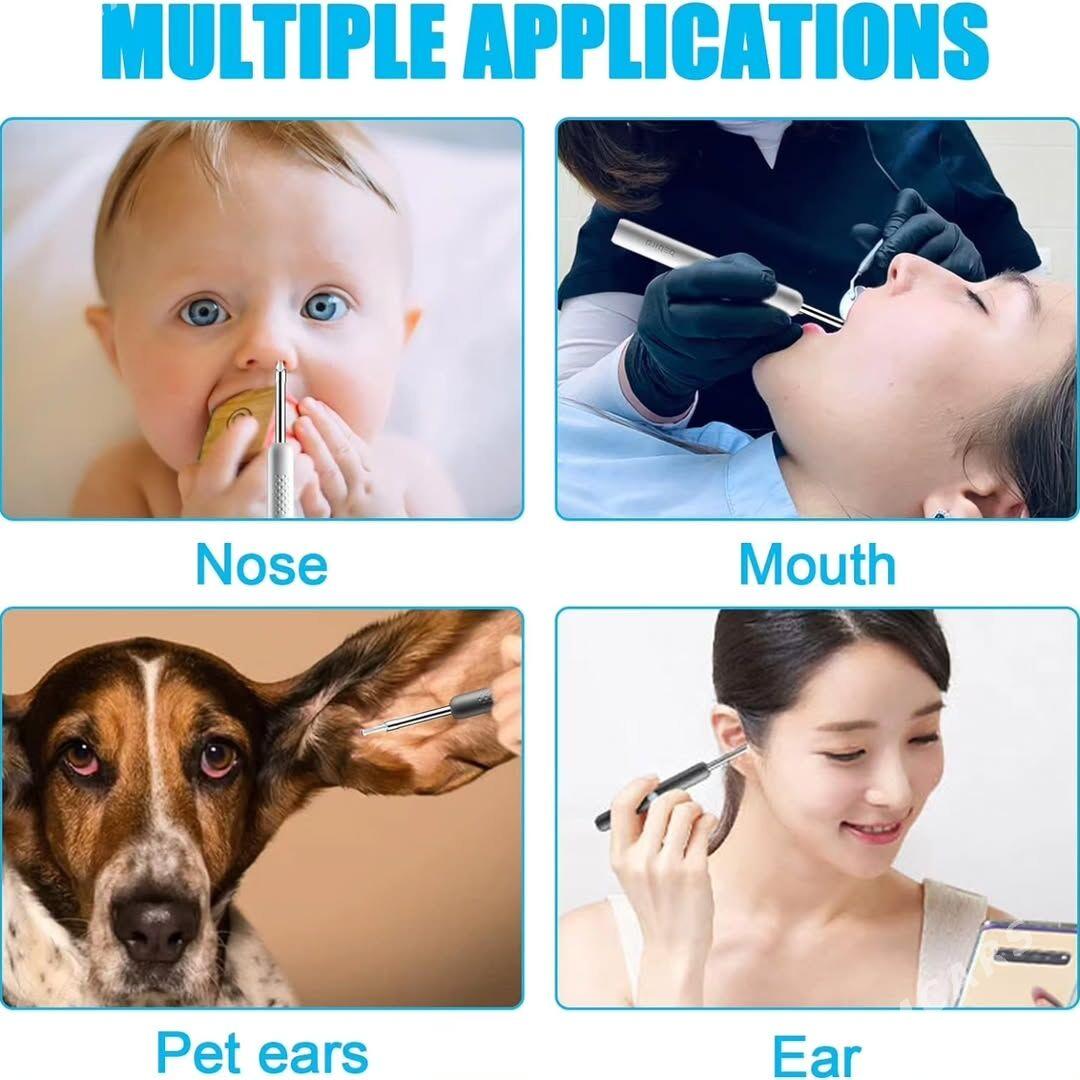 УШНАЯ ПАЛОЧКА XIAOMI BEBIRD R1 - Ашхабад - img 5