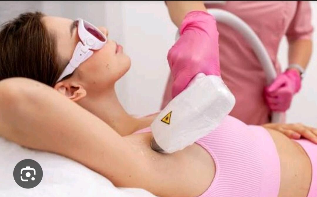 Lazerni epilatsiya - Ашхабад - img 4