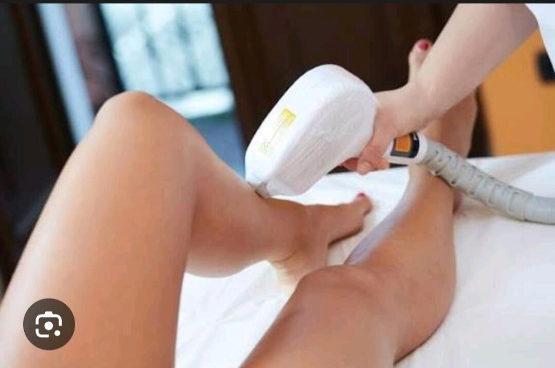 Lazerni epilatsiya - Ашхабад - img 3