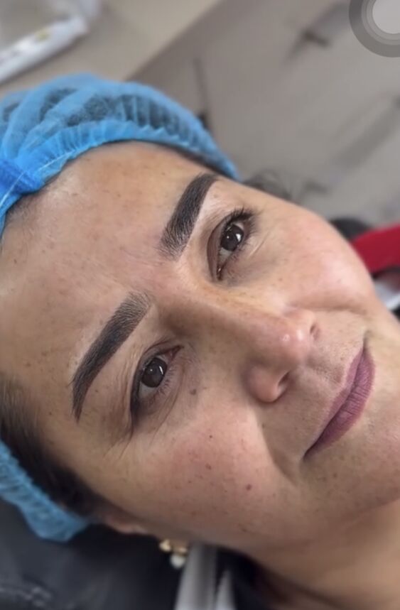 Permanent, mikrobleyding - Türkmenabat - img 2