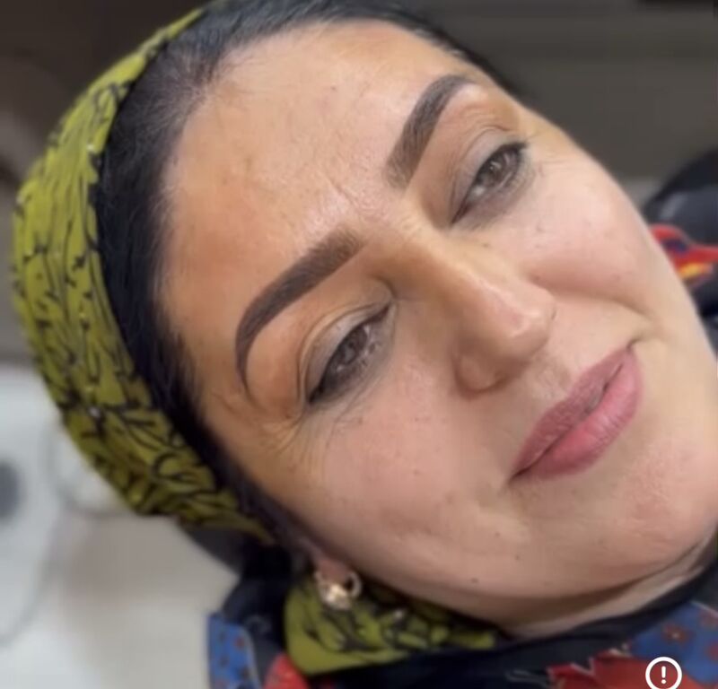 Permanent, mikrobleyding - Türkmenabat - img 5