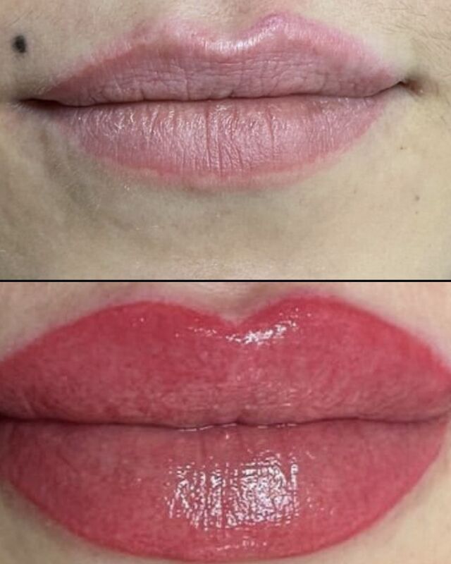 Permanent, mikrobleyding - Türkmenabat - img 3