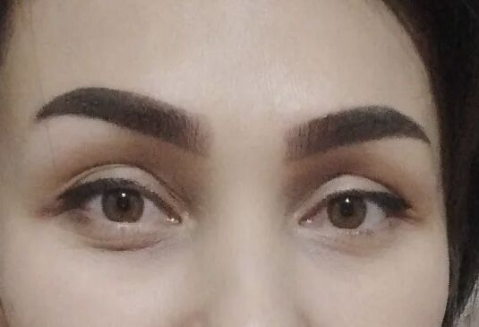 Permanent, mikrobleyding - Türkmenabat - img 8