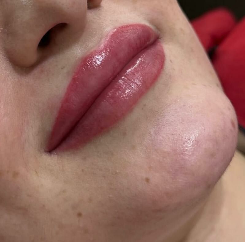 Permanent, mikrobleyding - Türkmenabat - img 6