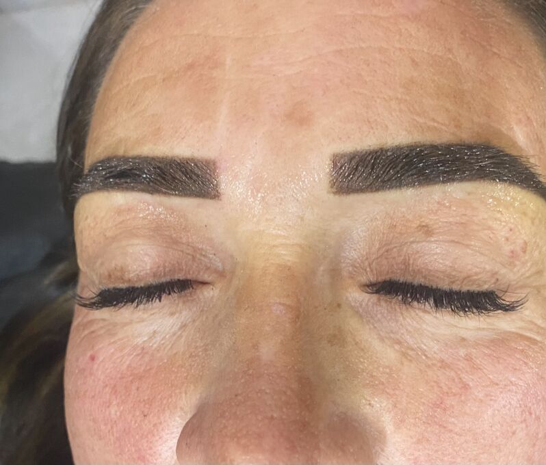 Permanent, mikrobleyding - Türkmenabat - img 7