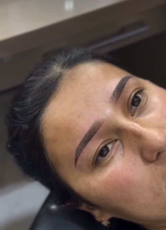 Permanent, mikrobleyding - Türkmenabat - img 4