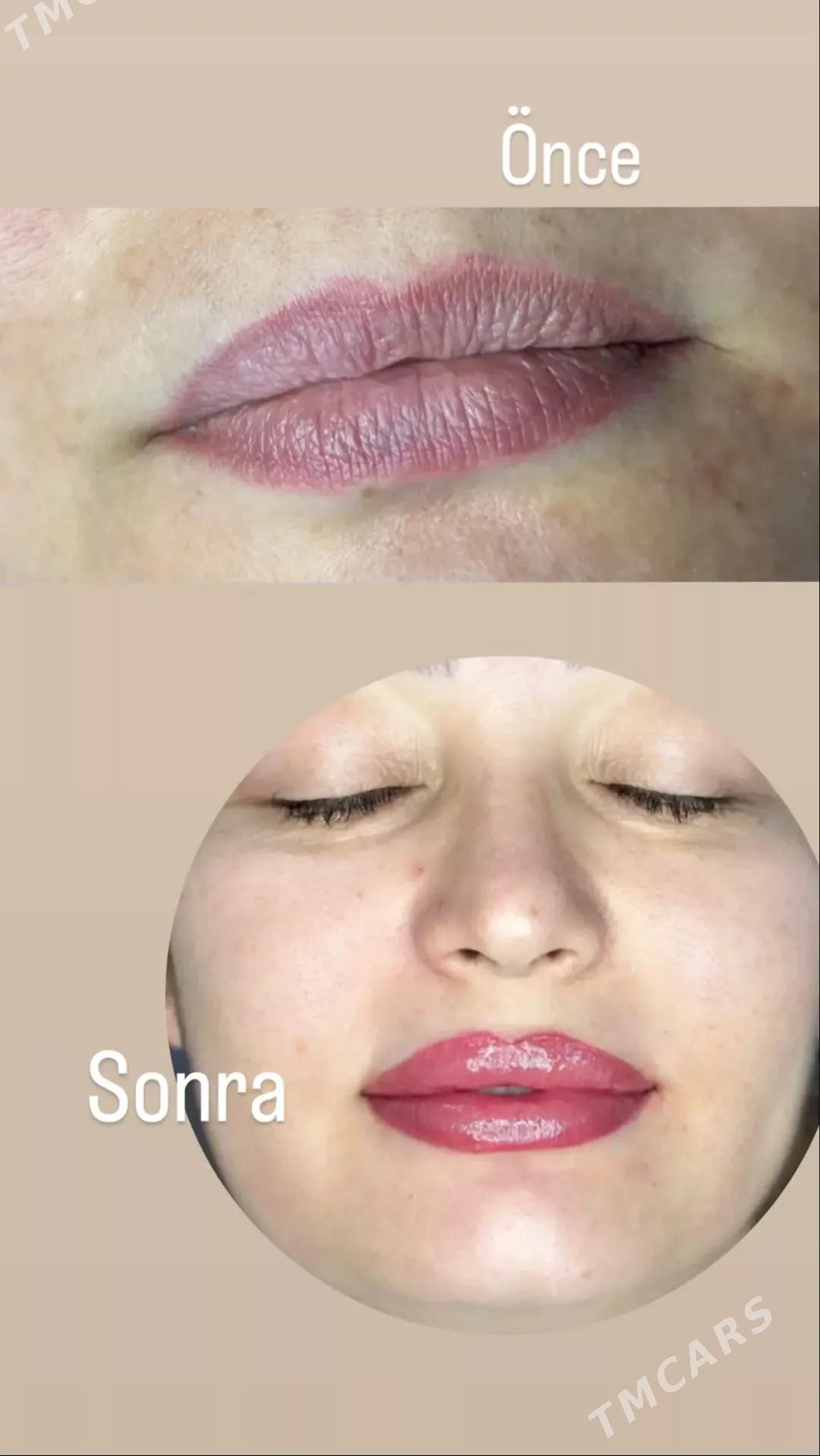 PERMANENT: GAŞ:DODAK: RESNIÇKA - Мир 4 - img 3