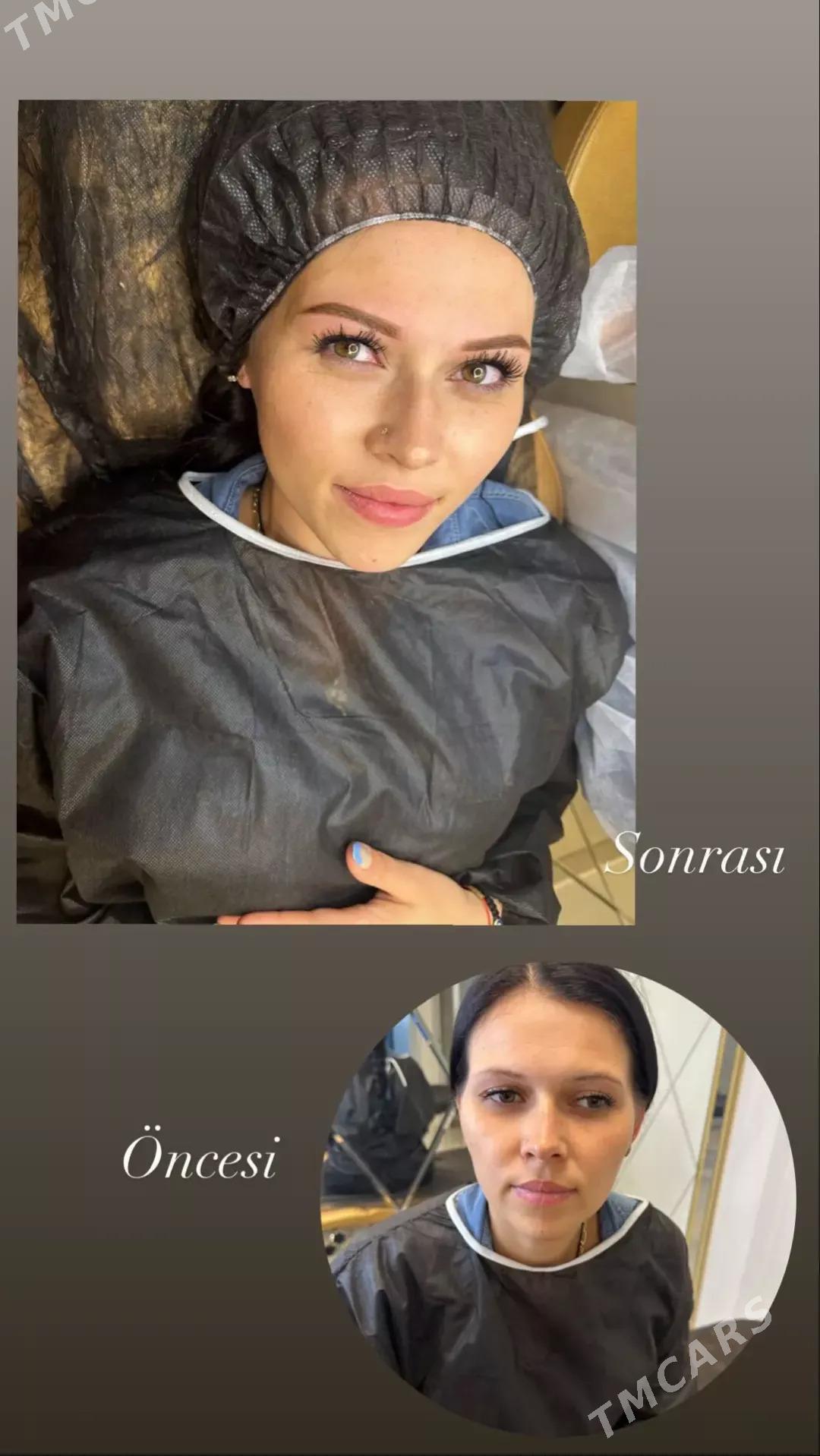 PERMANENT: GAŞ:DODAK: RESNIÇKA - Мир 4 - img 5