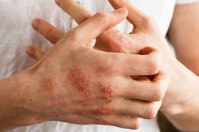 maz krem маз крем ayak agry - Daşoguz - img 3