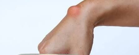 maz krem маз ayak omurga agry - Daşoguz - img 6