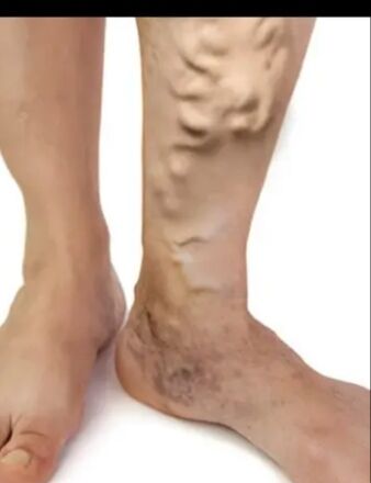 maz krem маз ayak omurga agry - Daşoguz - img 4