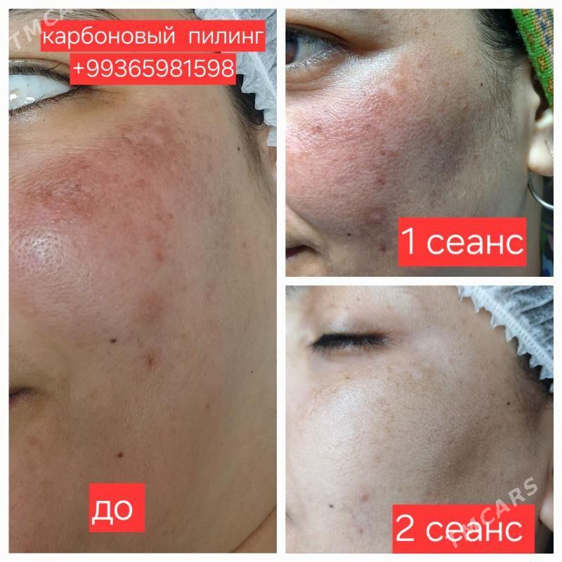 YUZ CISTKA  KARBONOWYY PILING - Мир 2 - img 3