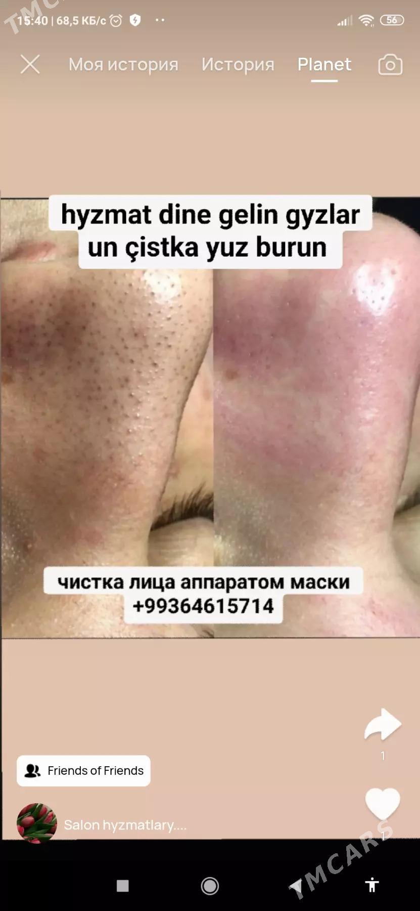 YUZ CISTKA  KARBONOWYY PILING - Мир 2 - img 6