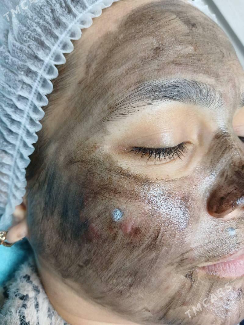 YUZ CISTKA  KARBONOWYY PILING - Мир 2 - img 2