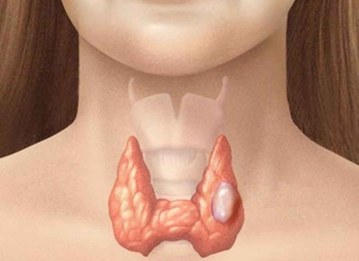 maz krem маз ayak omurga agry - Daşoguz - img 5