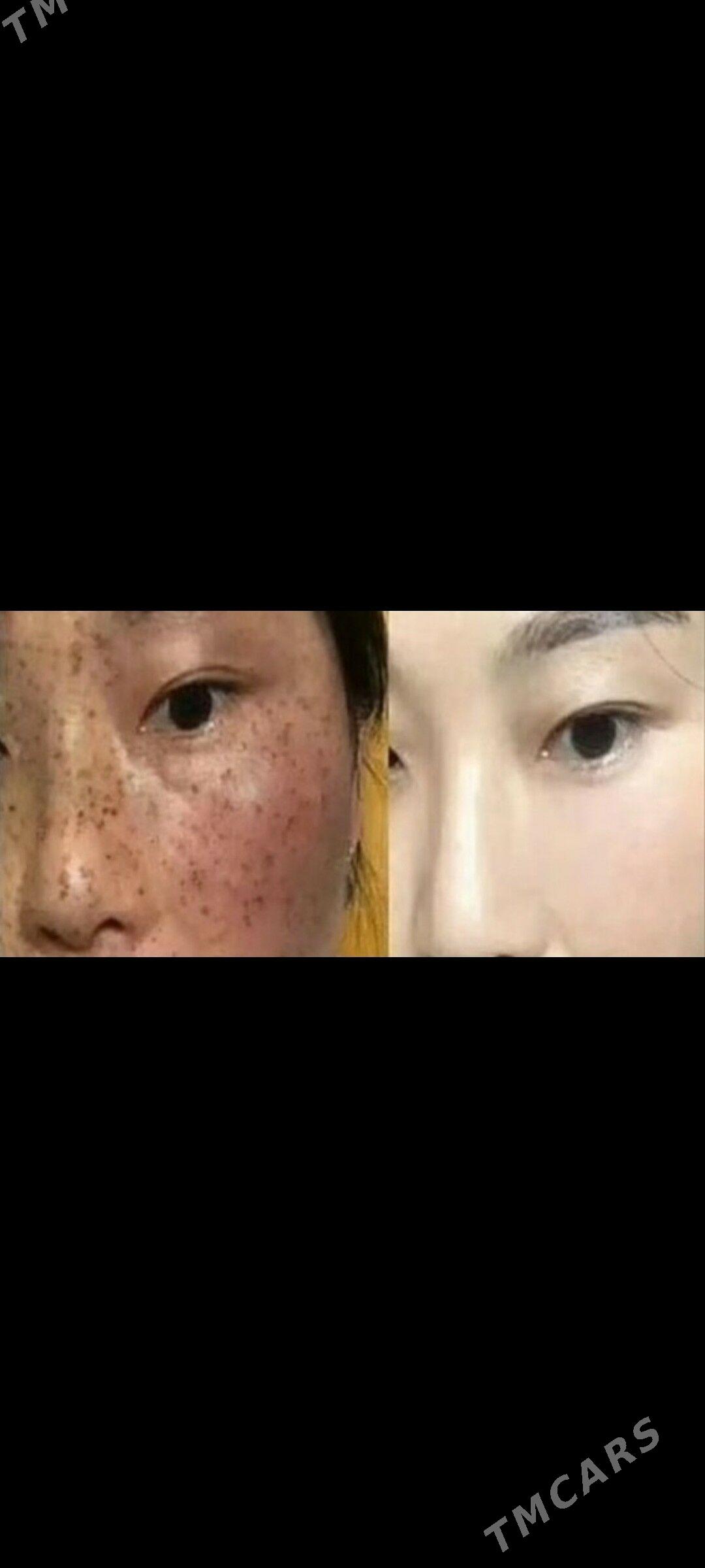 крем косметика kosmetika krem - Türkmenabat - img 3