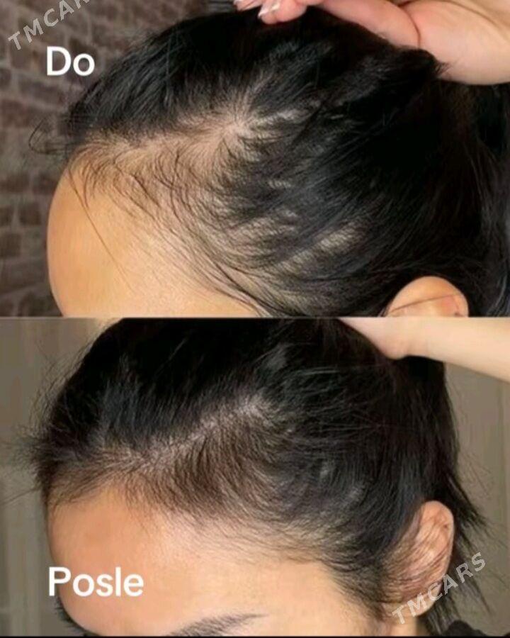 Shampun - Aşgabat - img 2