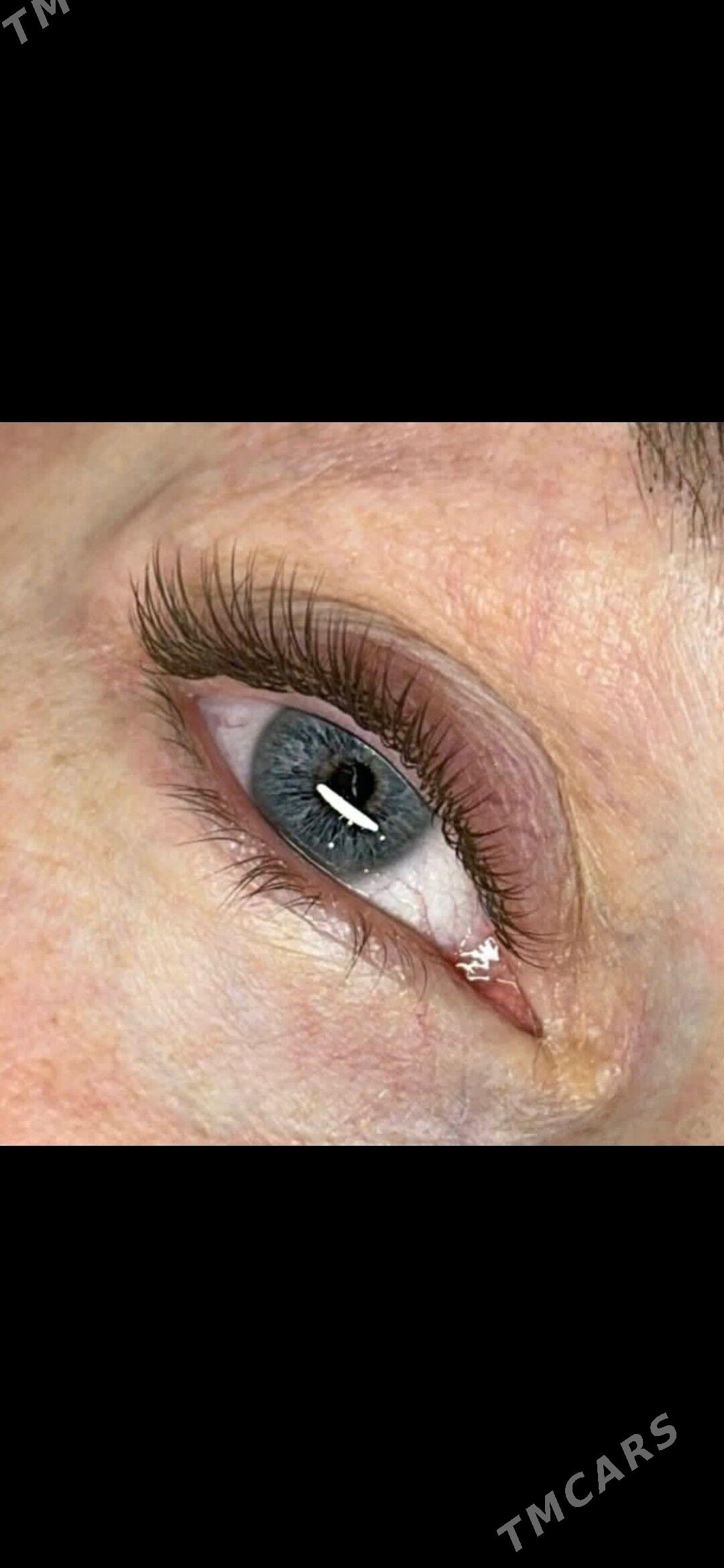 Kirpik naraşiwaniye - Parahat 2 - img 3