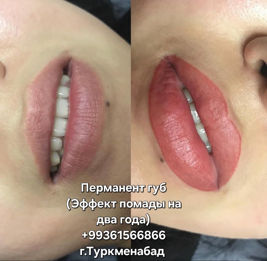 Новогодняя Скидка  - Туркменабат - img 3