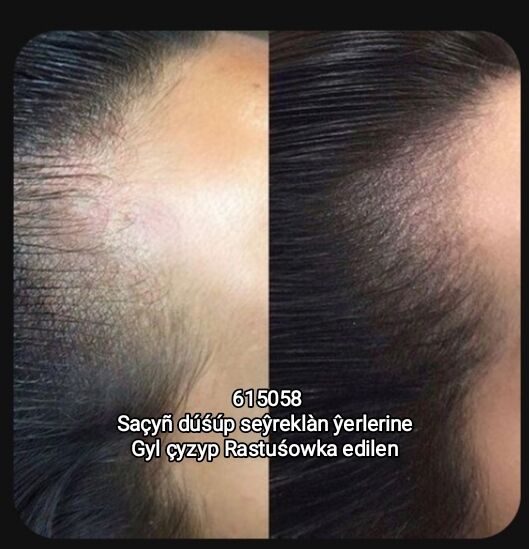 Gaś Kirpik Dodak salon - Ашхабад - img 5