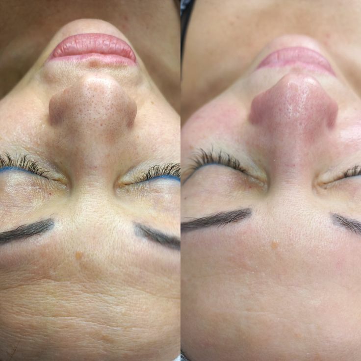 Gaś Kirpik Dodak salon - Ашхабад - img 8