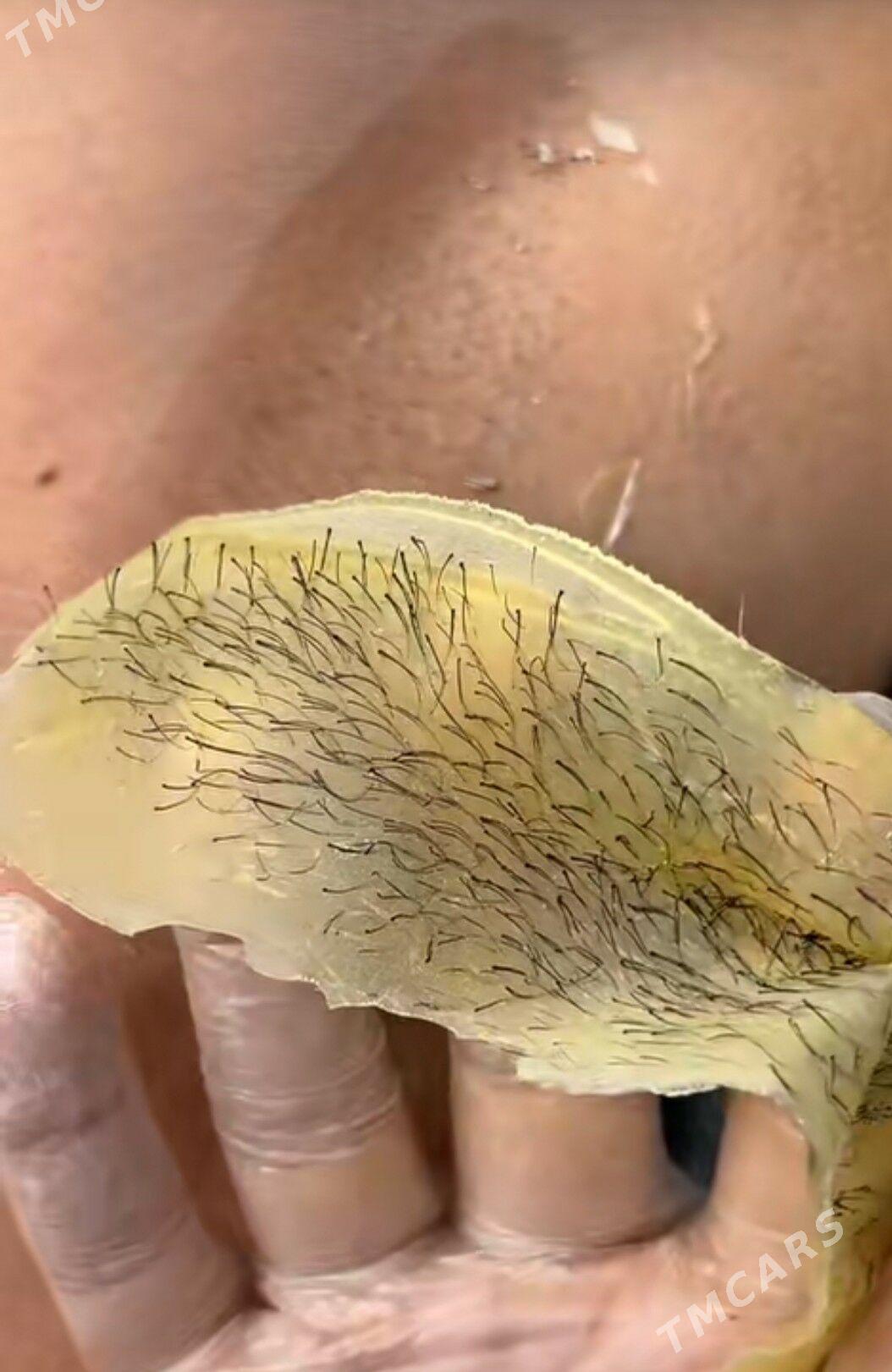 depilyasiya депиляция воском - Aşgabat - img 2