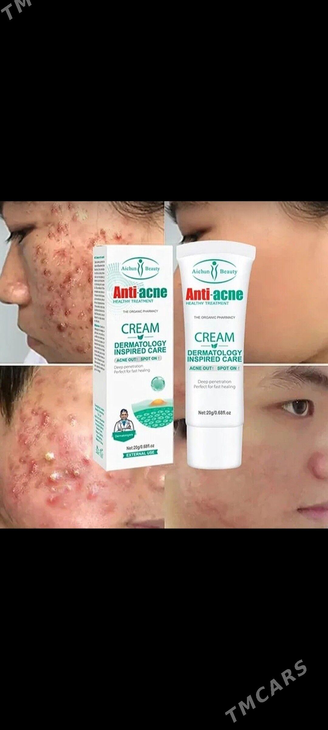 krem kosmetika крем косметика - Türkmenabat - img 1