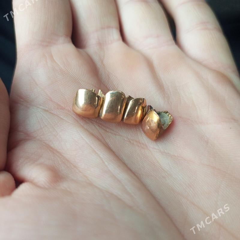 Gyzyl dis cisth - Halaç - img 1