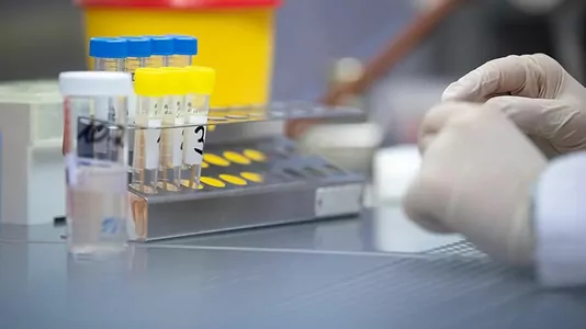 Kazan uniwersitetinde koronawirusa garşy sanjymlary barlagdan geçirip başladylar