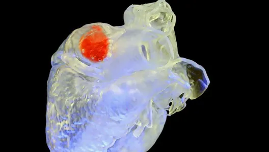 Американские врачи создали метод 3D-печати внутри человеческого тела