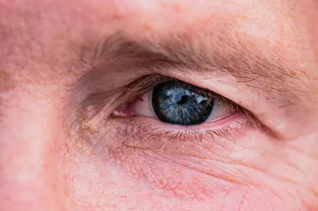 Ученые напечатали на 3D-принтере роговицу глаза, снизив риск отторжения