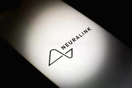 Neuralink beýnä oturdyljak gurluşlary üçin  «Telepatiýa» we «Telekinez» atlaryny hasaba aldyrdy