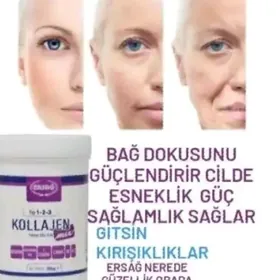 kollojen